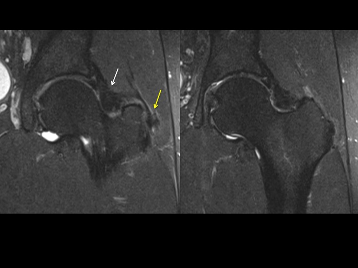 Figure 2 for case joint capsule ( RID6072 )